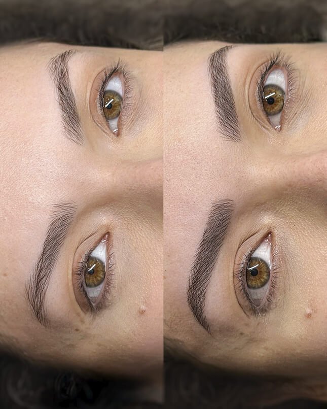 PROCEDIMENTO FIO A FIO 1