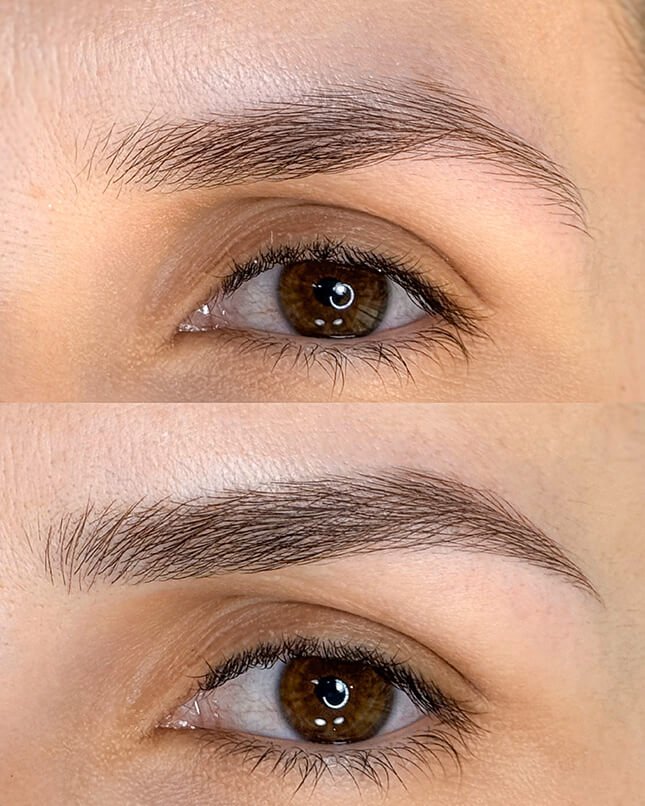 PROCEDIMENTO FIO A FIO 2