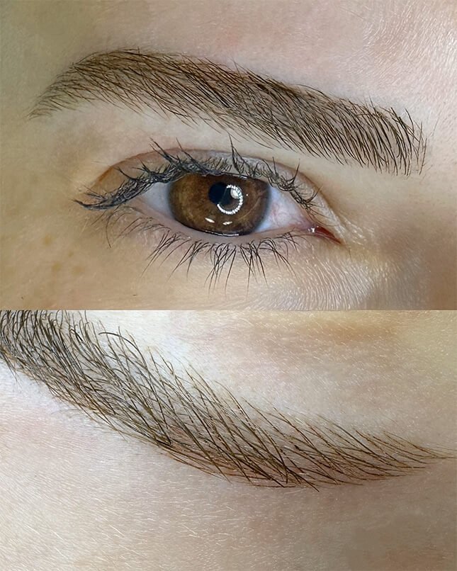 PROCEDIMENTO FIO A FIO 3