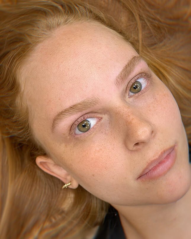 PROCEDIMENTO FIO A FIO 4