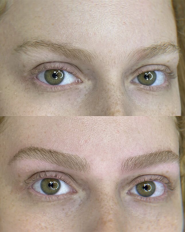 PROCEDIMENTO FIO A FIO 6