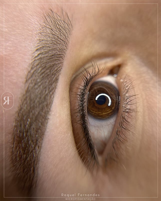 PROCEDIMENTO OLHOS 1