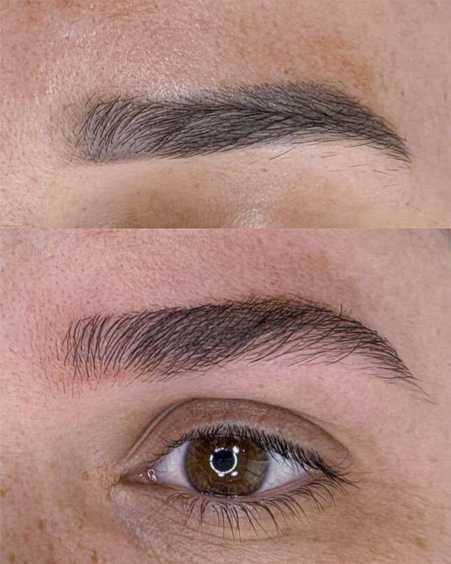 PROCEDIMENTO RECONSTRUÇÃO DE FIOS 2