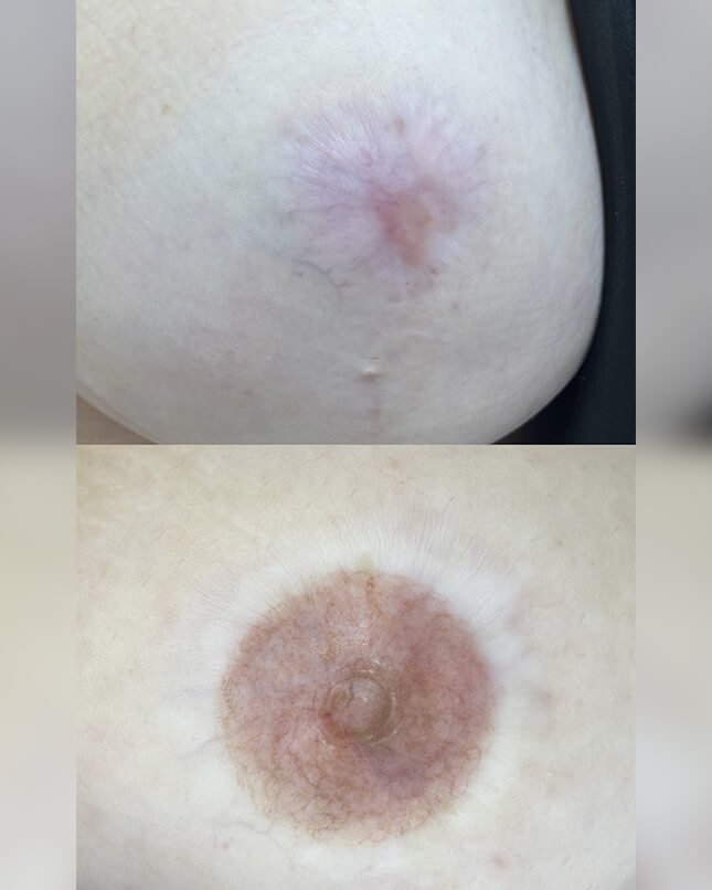 PROCEDIMENTO RECONSTRUÇÃO PARAMÉDICA 2