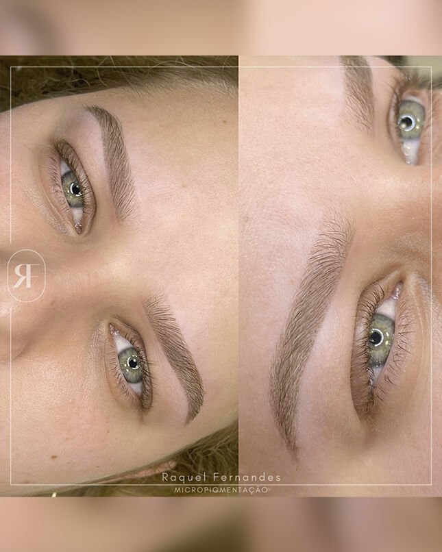 PROCEDIMENTO SHADOW 1