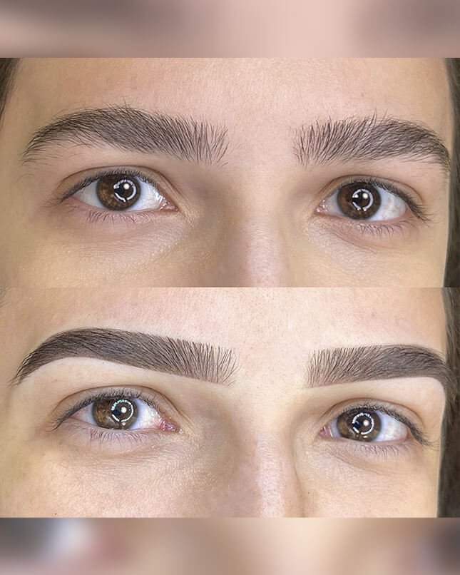 PROCEDIMENTO SHADOW 3