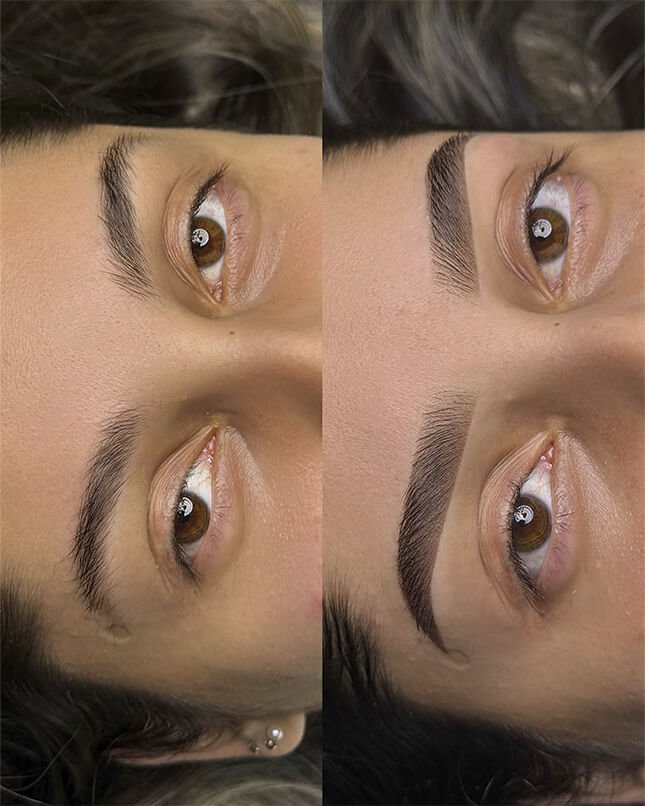 PROCEDIMENTO SHADOW 4