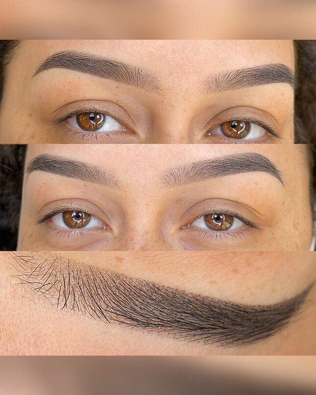 PROCEDIMENTO SHADOW 6